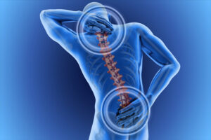 fibromialgia